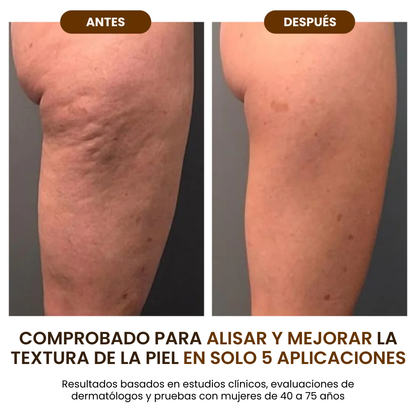 Goda™ Aceite Corporal Hidratante y Rejuvenecedor