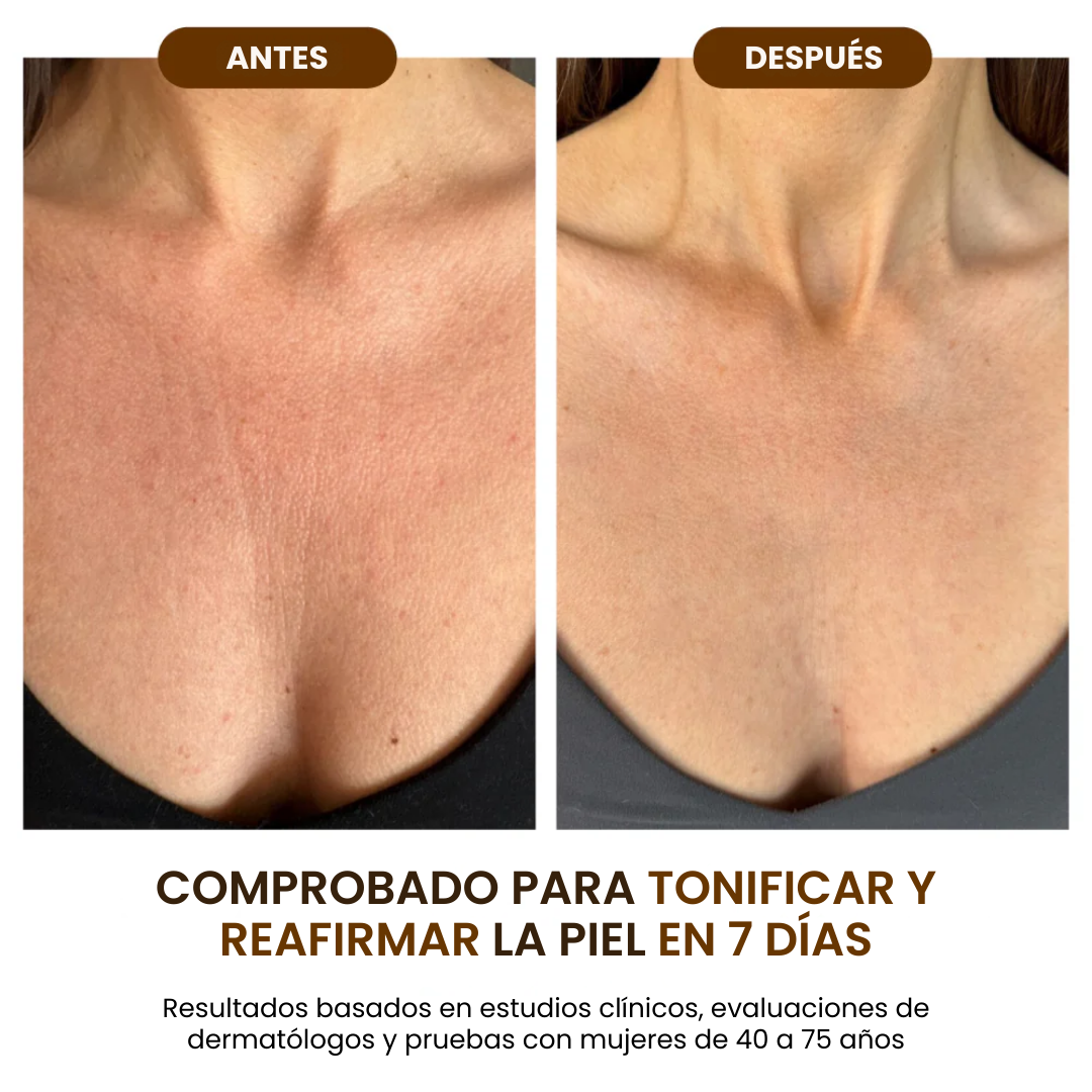 Goda™ Aceite Corporal Hidratante y Rejuvenecedor
