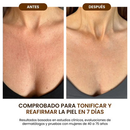 Goda™ Aceite Corporal Hidratante y Rejuvenecedor